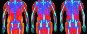 What are DEXA scans and what can they tell us about muscle?