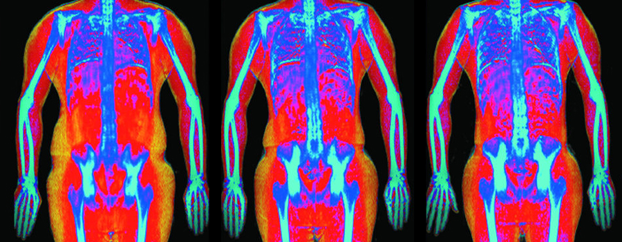 What are DEXA scans and what can they tell us about muscle?